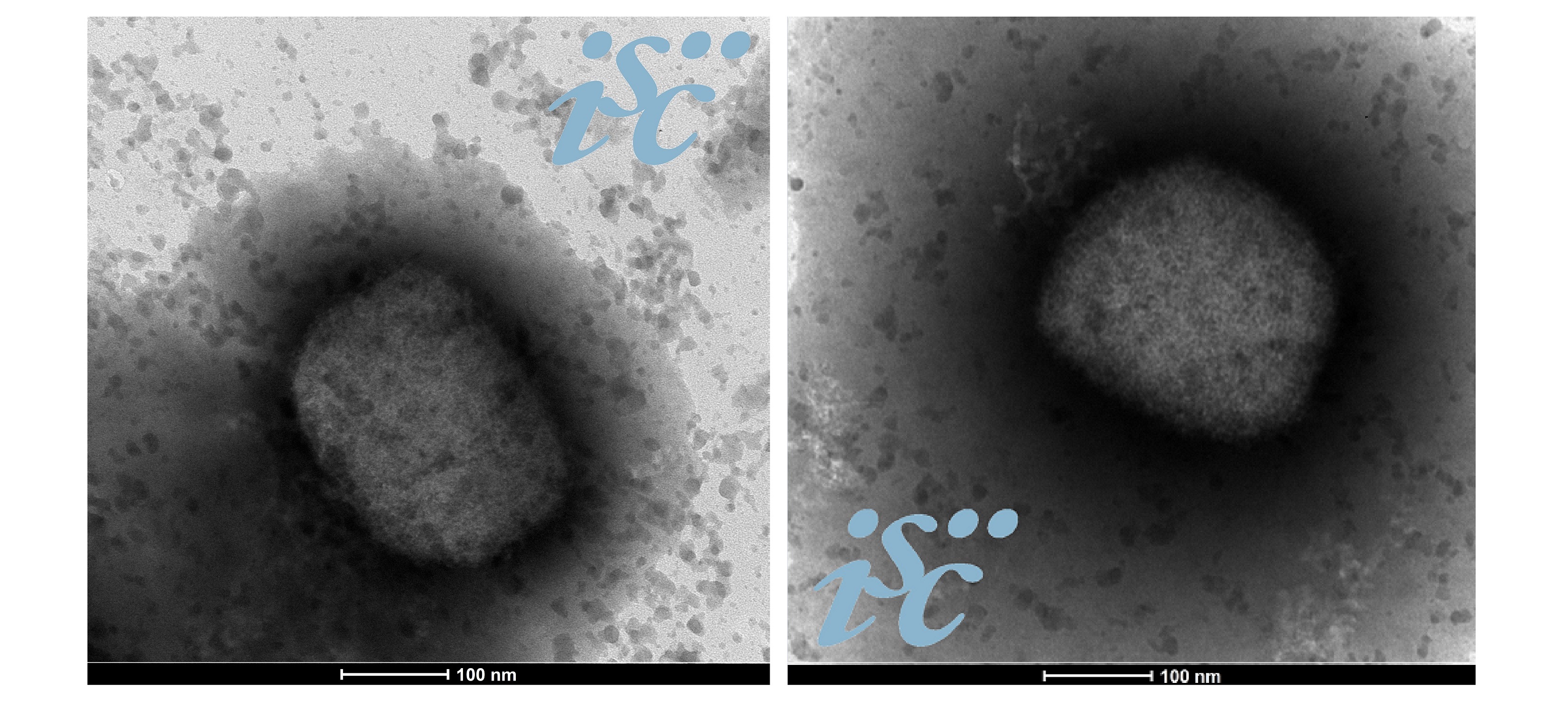 El virus mpox al microscopio, en imágenes obtenidas desde el Centro Nacional de Microbiología del ISCIII al inicio del brote de 2022.