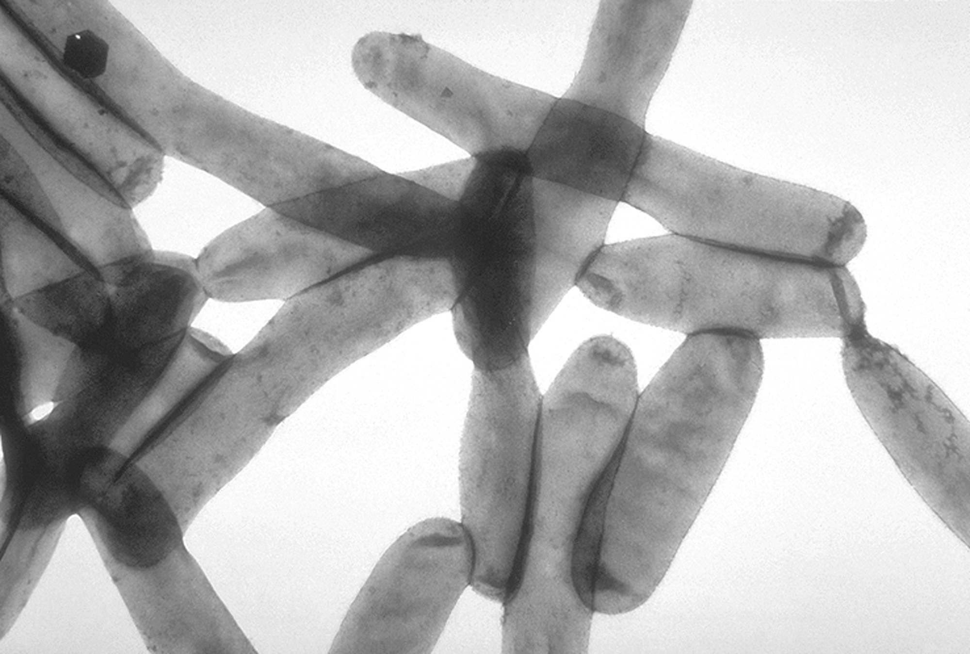 Imagen al microscopio de la bacteria Legionella Pneumophila (CDC Public Library of Health).