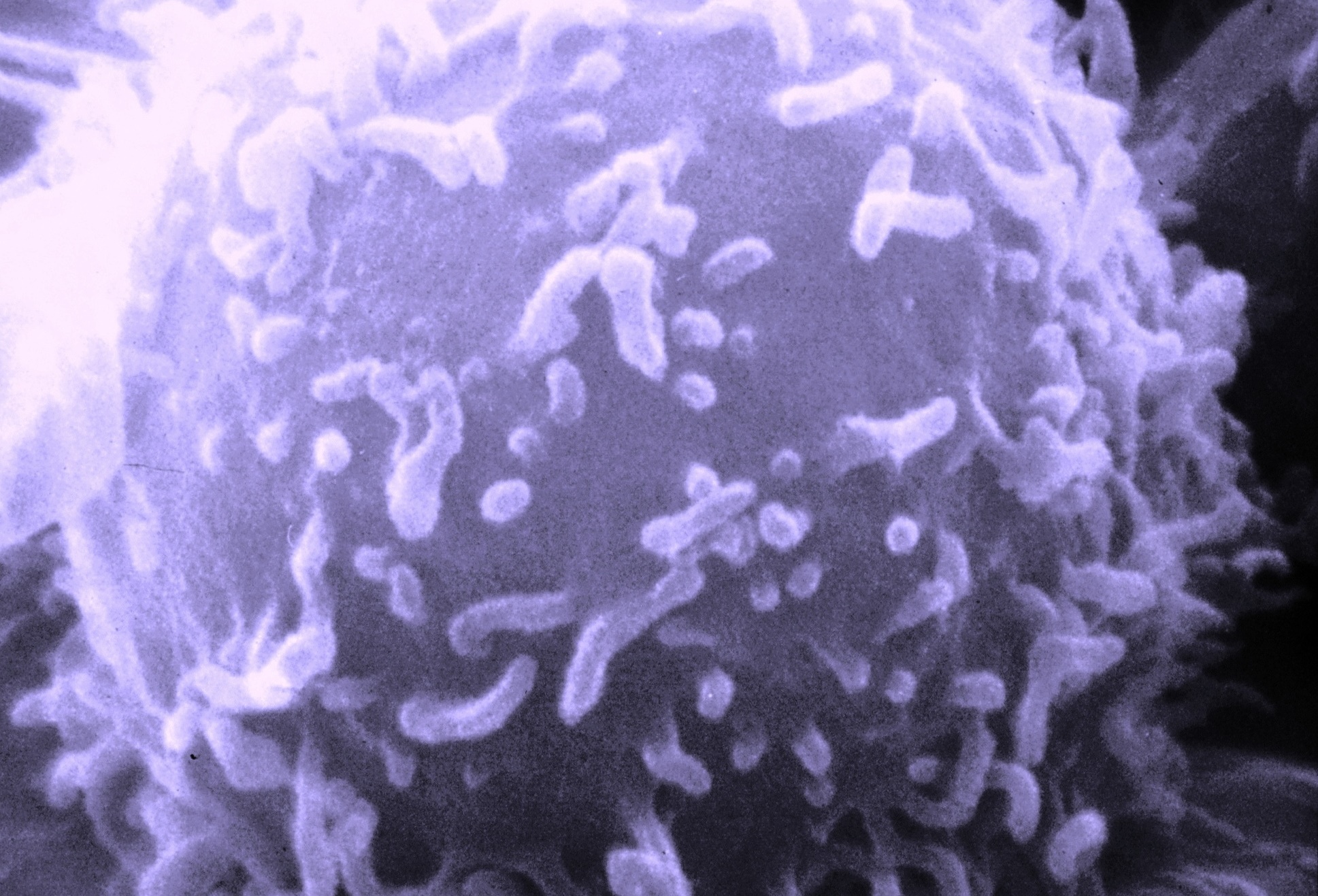 Imagen al microscopio de un linfocito B, uno de los tipos celulares más relevantes del sistema inmunitario.