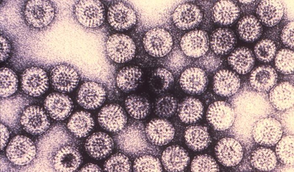 Imagen obtenido por microscopía electrónica de partículas de la cápside de rotavirus (CDC Public Imagen Library)..
